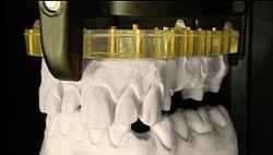 Delcam-DentSCAN-1152b