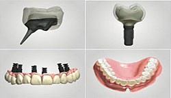 3shape-dental-1302