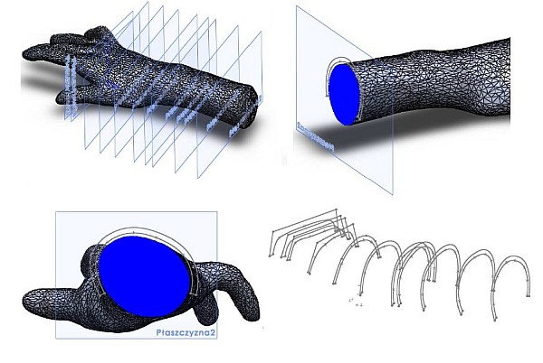 3D orteza cross section