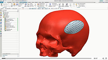 NX 11 convergent modeling-1638