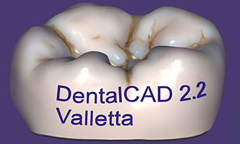 DentalCAD add text to any design-1815