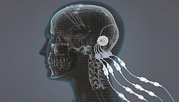 Parkinson image LR-1949