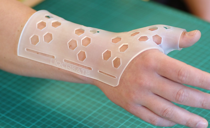 Arm-brace-3D-printed-using-Liqcreate-Bio-Med-Clear-2323