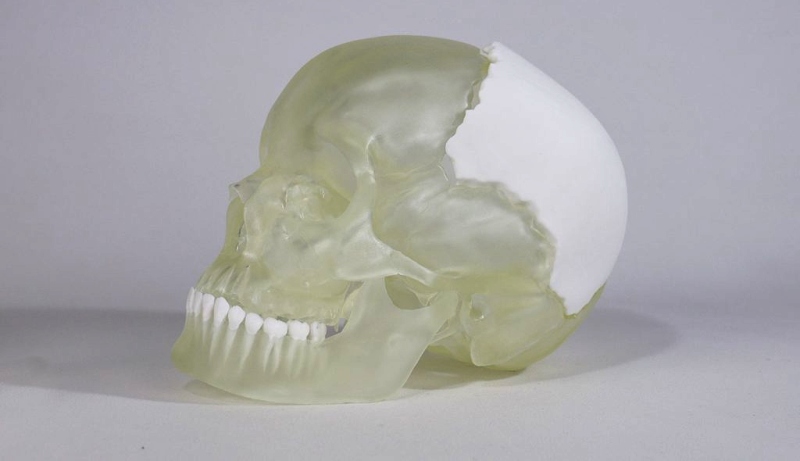 Medical-model-3D-printed-with-Liqcreate-Bio-Med-Clear-resin-2323