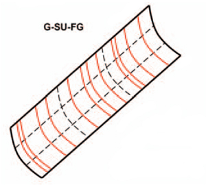 FraGmented surface: G-SU-FG – plocha složená z příliš mnoho částí (patches) FraGmented surface: G-SU-FG – plocha složená z příliš mnoho částí (patches)