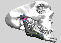 03-MEDIN_Orthopaedics1