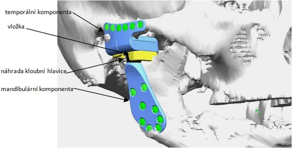 03-MEDIN_Orthopaedics2